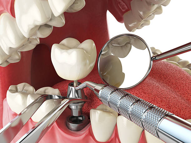 Best Emergency Treatment for Jaw Pain or Injury in Neenah, WI